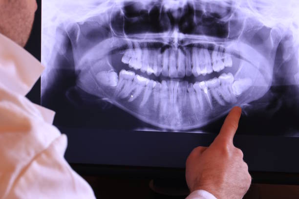 Best Emergency Dental Surgery in Oakwood Hls, IL